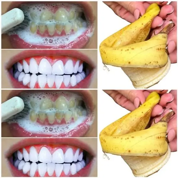 Easy & Natural Teeth Whitening with Banana Peels! 🌟