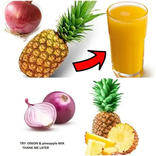 Onion and Pineapple May Seem Like a Weird Combo β But They Hold Amazing Healing Power You Can Use!