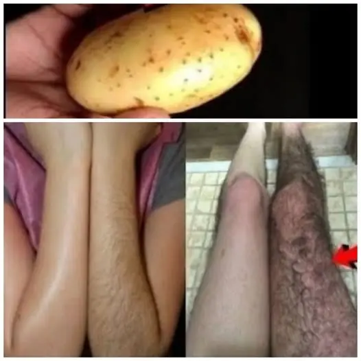 Hereβs How to Permanently Get Rid of Facial, Body, and Pubic Hair Using Potato! π₯β¨