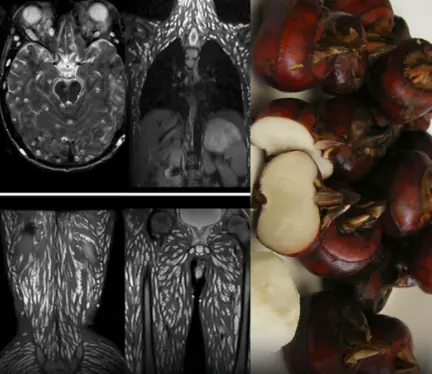Eating Just One Bite is Already Harmful, But Many Still Eat It Without Worry