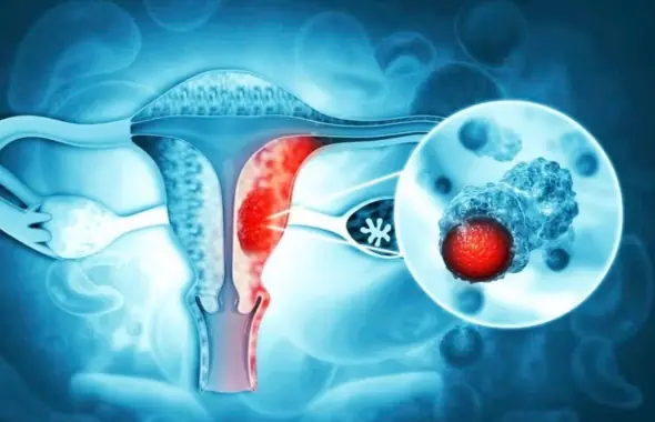 What You Should Know About Sexual Health and Cervical Cancer Risk