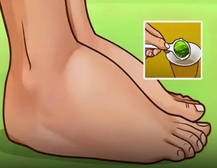 Say Goodbye to Swelling …