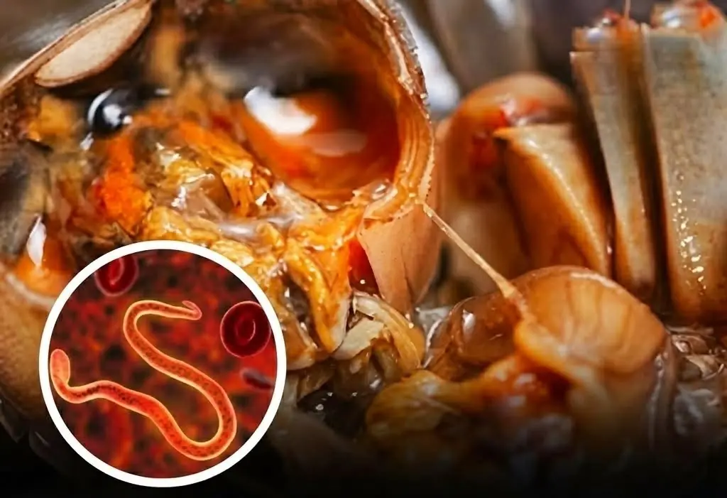 Sh:ocking Doctor’s Warning: You Might Be Eating Parasites in These 4 Common Foods